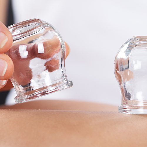 physiotherapy-center-cupping-therapy-msk-health-and-performance-clinic-vancouver-burnaby-metrotown-bc