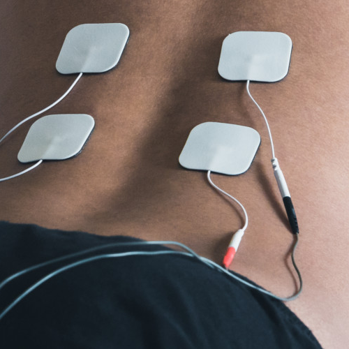 physiotherapy-center-muscle-stimulation-estim-msk-health-and-performance-clinic-vancouver-burnaby-metrotown-bc